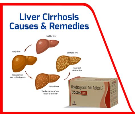 liverosis|Cirrhosis of the Liver: Symptoms, Causes & Treatments